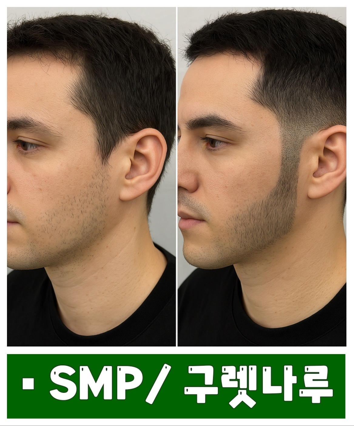 3555378732_YbAsqzBG_b0b1b23f08193b6e84ebd4b89620f42c5da330d3.jpg 이미지크게보기